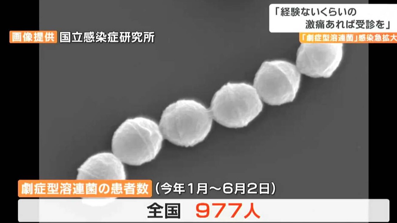 什麼是食人菌?去日本旅行該如何防範?赴日前你一定要知道的注意事項