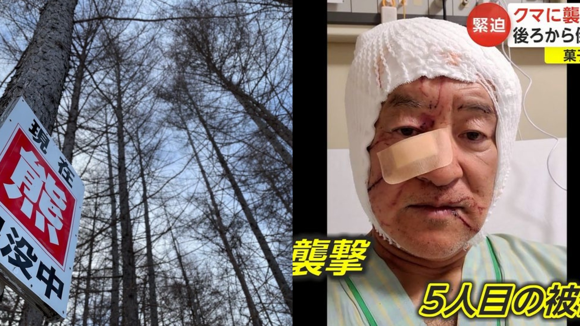 採訪後立刻遭熊襲?日本熊頻繁出沒去賞楓請務必小心!